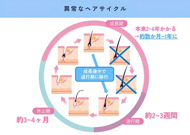 ダイエットで薄毛にならないために